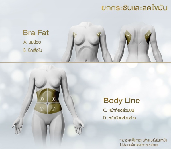 ดูดไขมัน