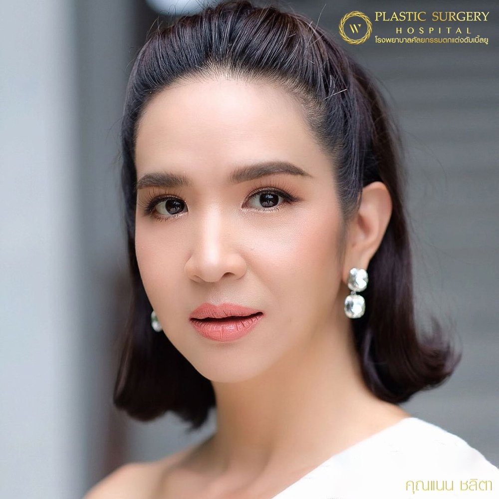 ศัลยกรรมแก้ไขปัญหาหนังตา